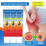 Creme Naturel Anti-Hémorroïdes – Soulagement Rapide et Apaisant